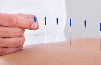 Akupunkturun Modern Tıbdaki Yeri